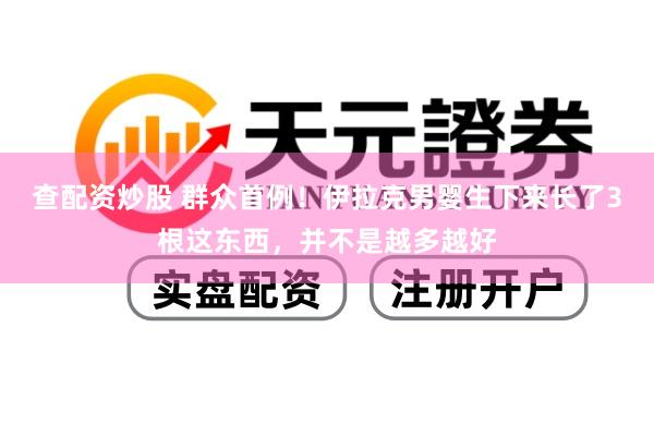 查配资炒股 群众首例！伊拉克男婴生下来长了3根这东西，并不是越多越好